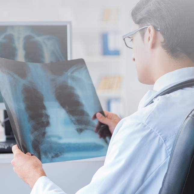Doctor examines lung x-ray